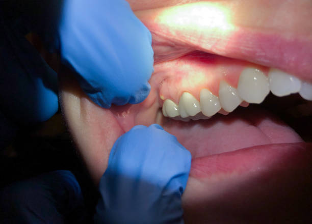 Best Orthodontic Emergency Dentist in Monsey, NY